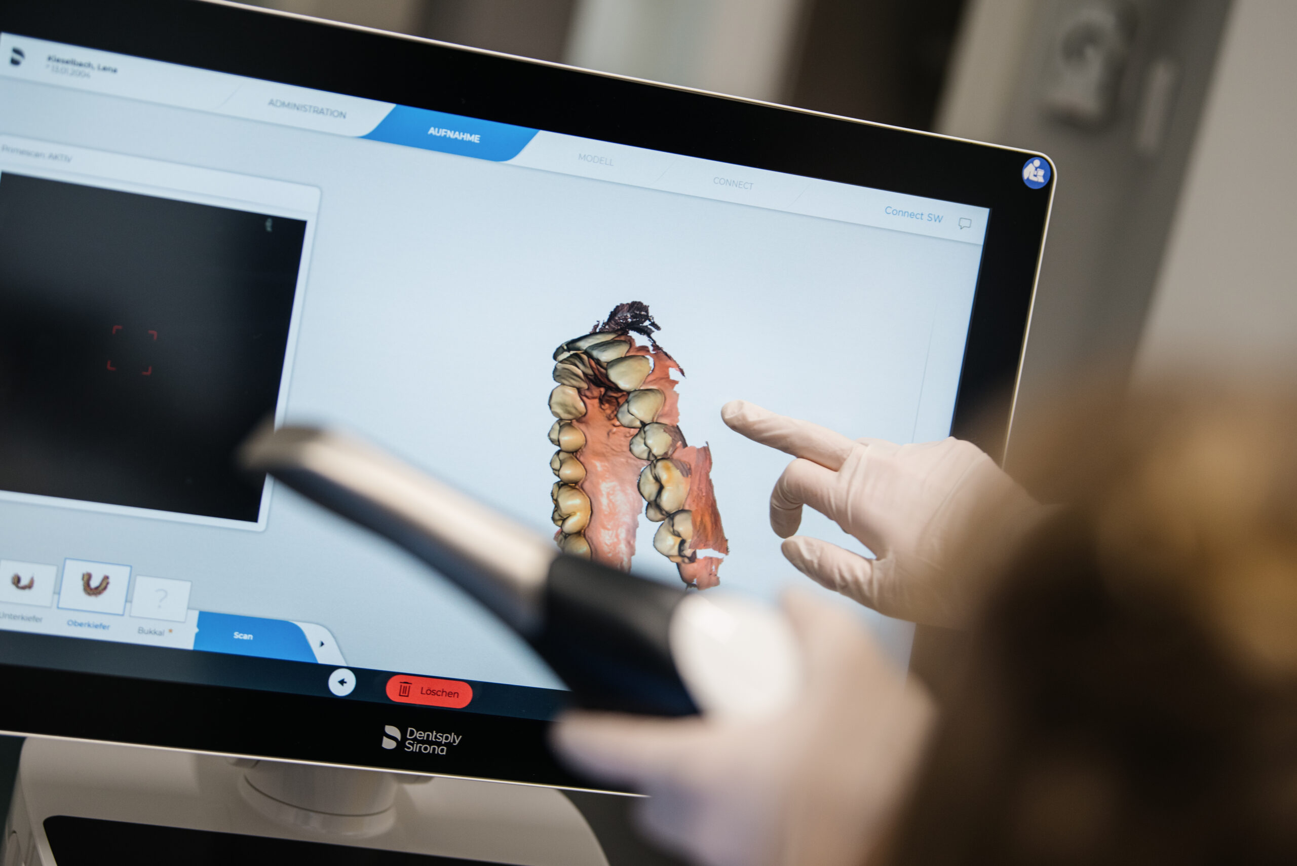 Intraoralscan_Brücke
