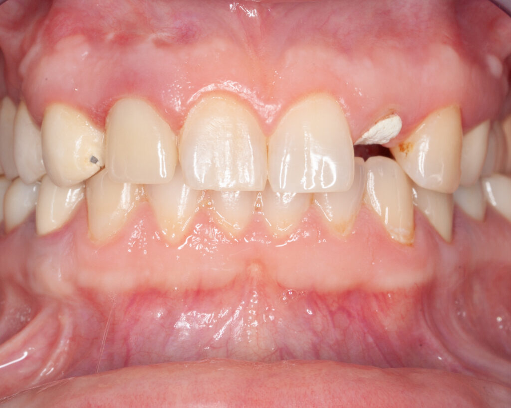 01_clinical_initial situation