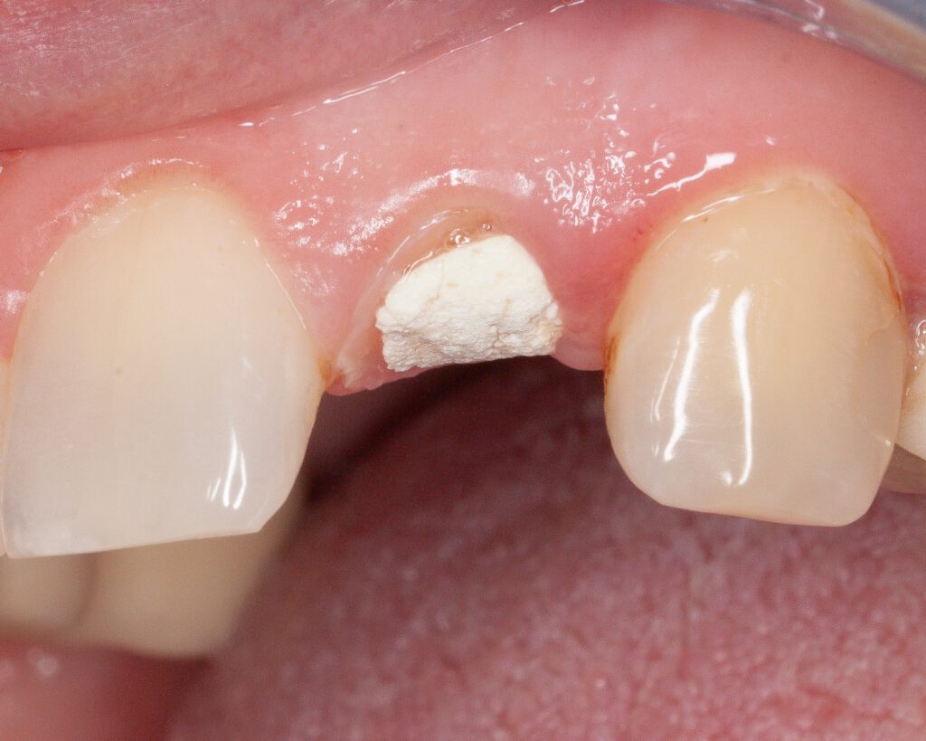 02_clinical_initial situation_labial