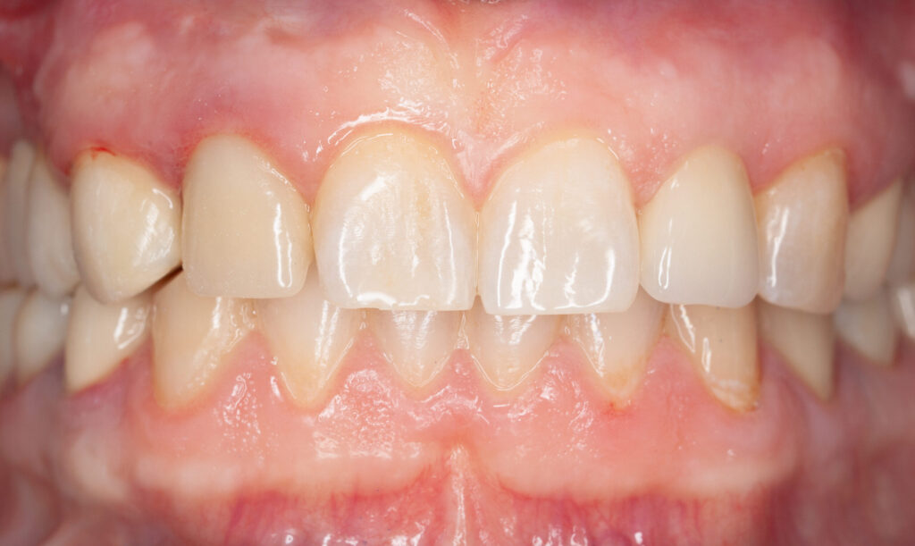 19_clinical_final result