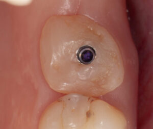 20260202- molar